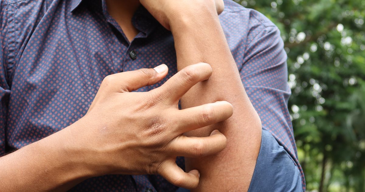 Psoriasis vs Eczema vs Dermatitis: Key Differences Explained