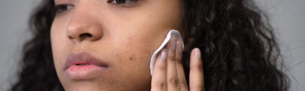 Dark spot serum guide covering brightening ingredients, realistic expectations, and daily sunscreen.