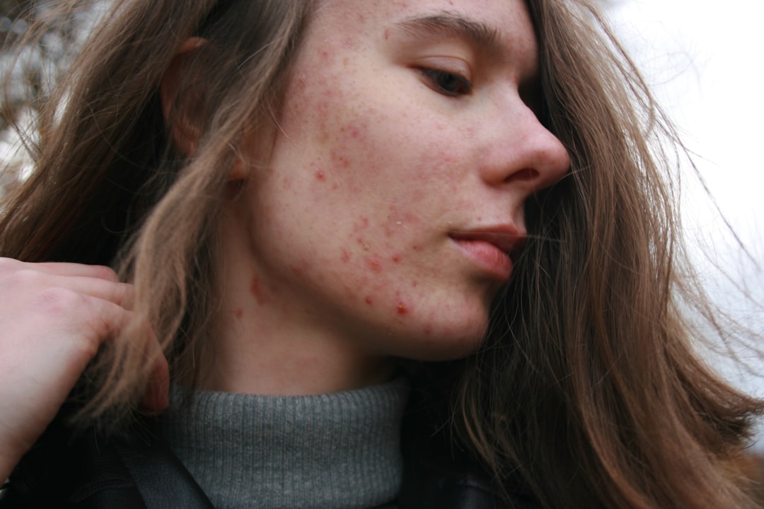 Weeping Eczema: When to Seek Help & How to Support Your Skin