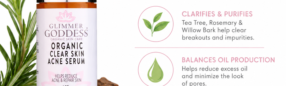 Glimmer Goddess Organic Clear Skin Acne Serum featured in a guide to skincare for oily skin.