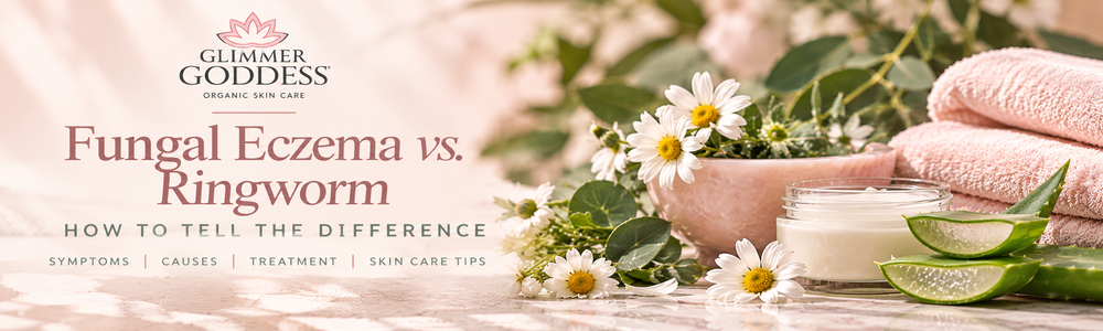 Fungal Eczema vs. Ringworm: How to Tell the Difference — luxury botanical Glimmer Goddess educational guide