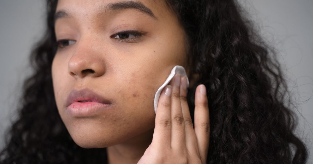 Best Dark Spot Remover Face 2026: Top 5 Ranked