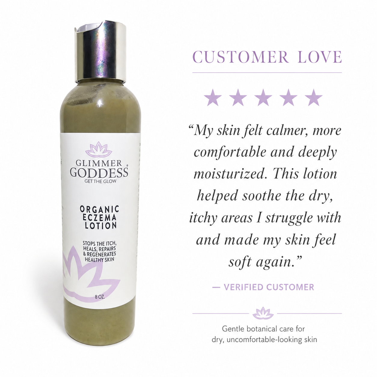 Five-star customer review for Glimmer Goddess Organic Eczema Lotion for dry, itchy and uncomfortable-looking skin